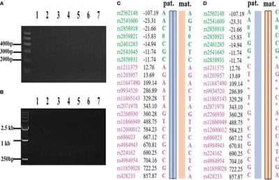 Appropriate whole genome amplification and pathogenic loci detection can improve the accuracy of preimplantation genetic diagnosis for deletional α-thalassemia